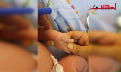 بالصور-القيروان: عائلة تشوه جسد رضيع عمره 10 أيام لـ"معالجته"